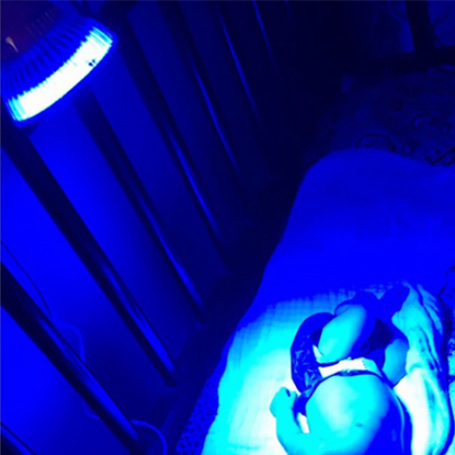LED лампа для фототерапии лечит новорожденного