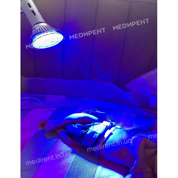 Облучение ультрафиотетовым светом с помощью LED лампы для лечения желтушки у новорожденных